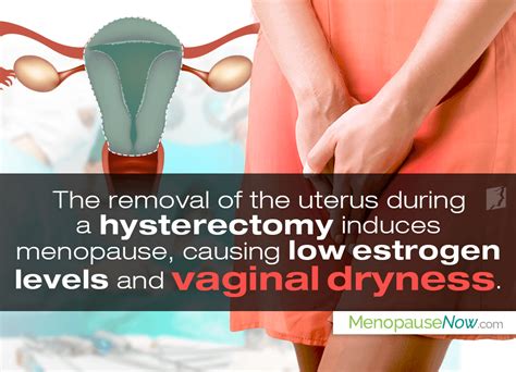 How A Hysterectomy Affects Vaginal Dryness Menopause Now