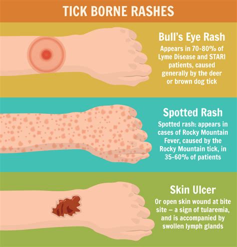 Tick Bite Rash Pictures Humans