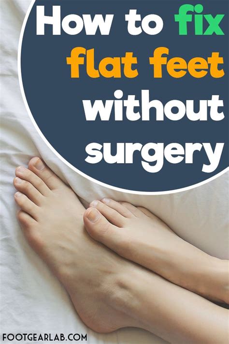 How To Fix Flat Feet Without Surgery Flat Feet Surgery Pros And Cons