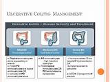 Pictures of Medical Treatment Of Ulcerative Colitis