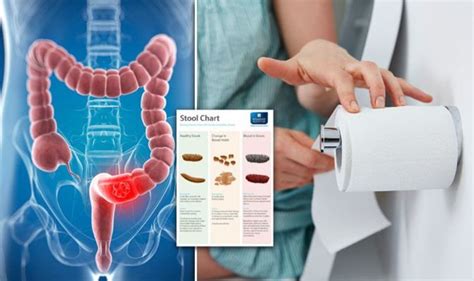 Bowel Cancer Symptoms Signs Of A Tumour Include Red Blood In Poo