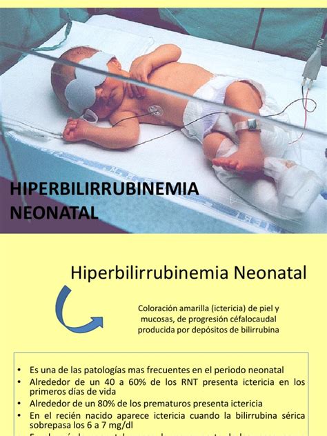 Hiperbilirrubinemia Pdf Pdf