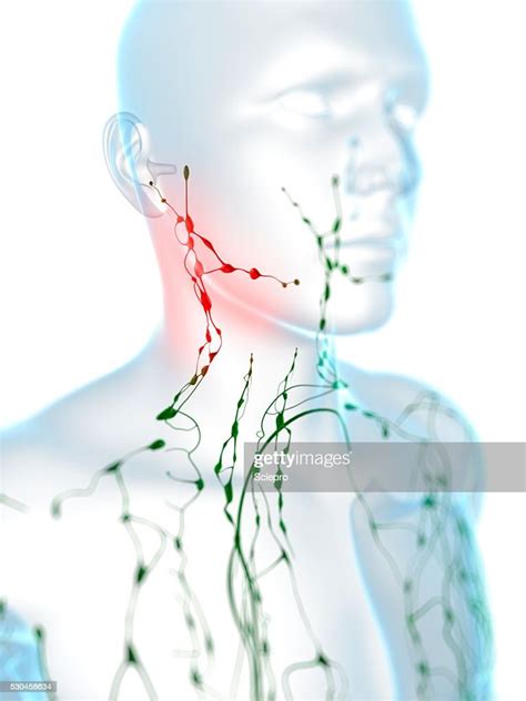 Swollen Lymph Nodes Artwork High Res Stock Photo Getty Images