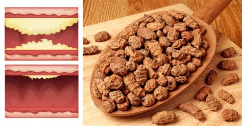 Benefits Of Tiger Nuts Diabetes Prevention Lowered Cholesterol