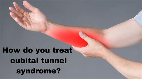 How Is Cubital Tunnel Syndrome Diagnosed Managed And Treated Youtube
