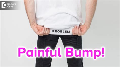 Painful Bump On Buttocks Causes Symptoms Treatment Dr Rajdeep My XXX