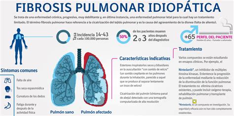 Tratamiento para la fibrosis pulmonar. Neumonólogos argentinos estiman un crecimiento en los casos de Fibrosis Pulmonar en el país
