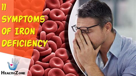 11 Symptoms Of Iron Deficiency You Must Not Ignore Youtube