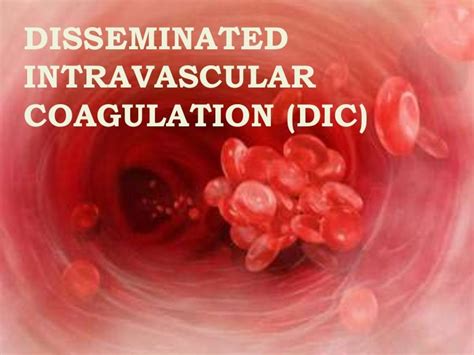 05 disseminated intravascular coagulation