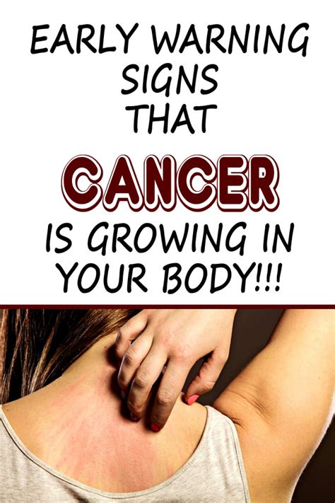5 Early Cancer Symptoms You Shouldnt Ignore