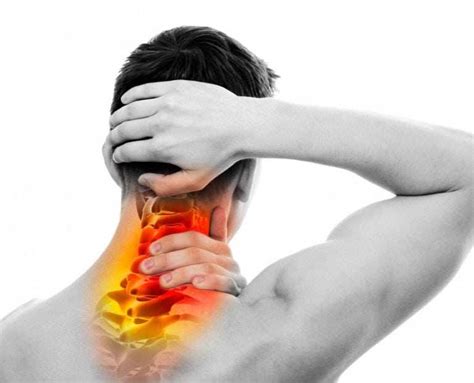 Chronic Neck Pain Stiff Neck Pain Cervical Neck Pain