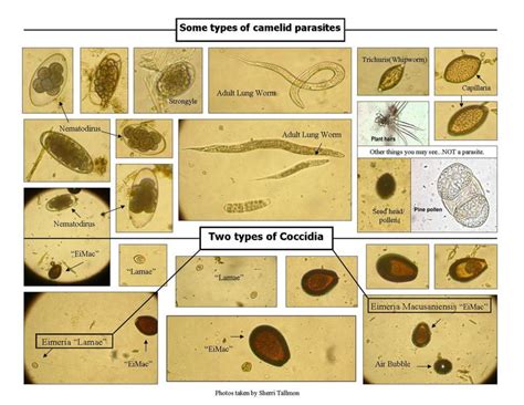 Are You Being Poisoned By Parasites Parasite Medical Laboratory