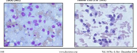 Figure 1 From The Usefulness Of Cytological Grading Of Breast Cancer As