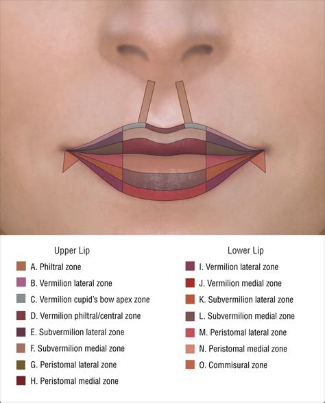 A New Classification Of Lip Zones To Customize Injectable Lip