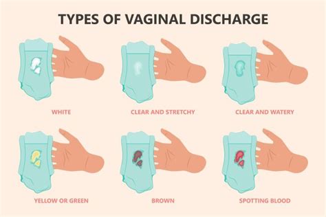 Discharge During Pregnancy When Can It Be A Sign Of A Problem
