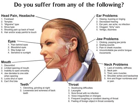 Arthritis In The Jaw Migraine Dental Tubuh