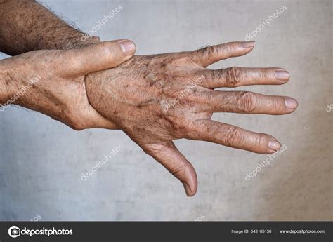 Age Spots Hands Asian Elder Man Brown Gray Black Spots Stock Photo By