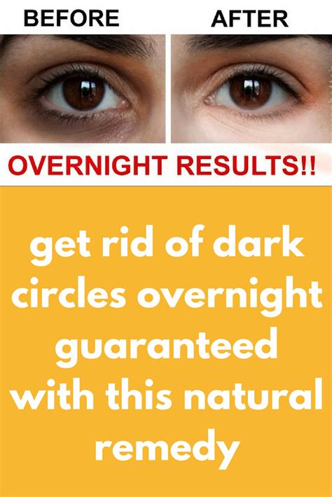Get Rid Of Dark Circles Overnight Guaranteed With This Natural Remedy