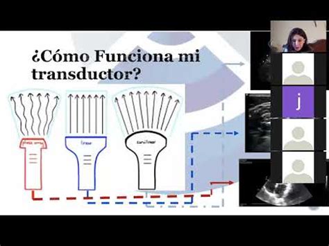 Ecocardiograma Ultrasonido Por Transductor Transductor Net