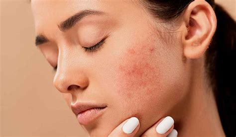 Skin Discoloration - Types, Causes, Treatment, & Much More - Health