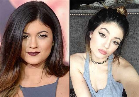 Kylie Jenner Finally Opens Up On Plastic Surgery Lifestyle News