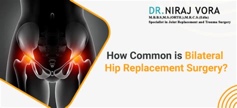 How Common Is Bilateral Hip Replacement Surgery