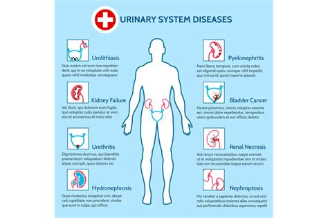 Urinary System Diseases By Vectortatu Thehungryjpeg