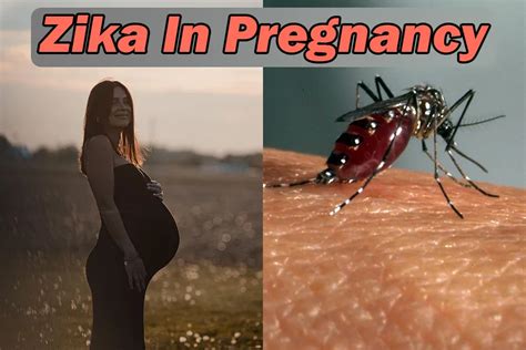 zika in pregnancy signs prevention home remedy hipregnancy