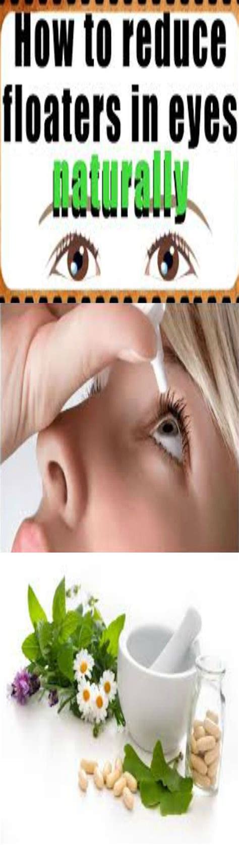 Top 15 Home Remedies For Eye Floaters Holistic Health Remedies Eye
