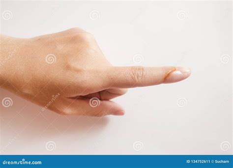 The Lesion From Cut By A Knife At Index Finger Stock Image Image Of