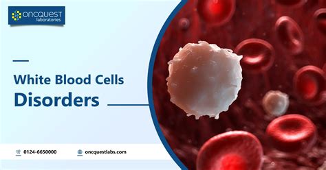 White Blood Cells Disorders Oncquest Blog Your Health Guide