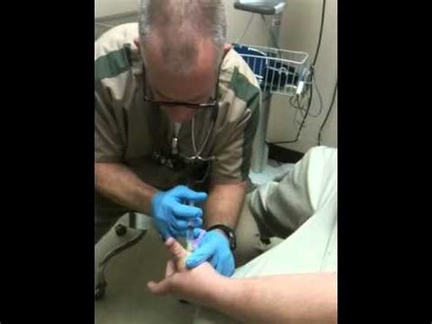 Maybe you would like to learn more about one of these? Dislocated thumb - YouTube
