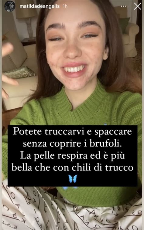 From the undoing to sanremo everything you need to know about the actress of the moment. Matilda De Angelis: foto più belle con brufoli e seno ...