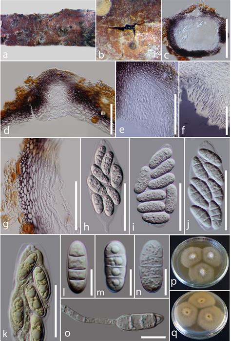 Phragmoporthe Conformis Facesoffungi Number Fof 01794 Faces Of Fungi