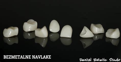 Zubne Krunice Vrste I Cijene Dental Estetic Studio Dr Knego