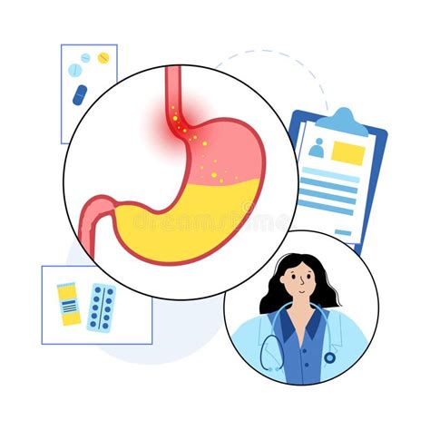 Gastroesophageal Reflux Disease Stock Vector Illustration Of Stomach