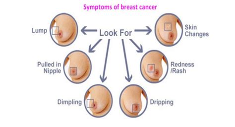 White so what do prevention and early detection look like? HOW CAN BREAST CANCER BE DETECTED - HEALTHY FOOD ADVICE