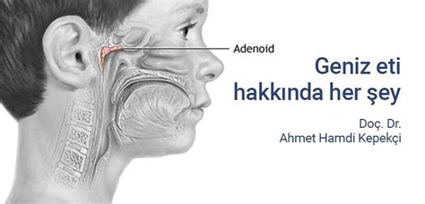Geniz Eti Ameliyatı Doç Dr Ahmet Hamdi Kepekçi