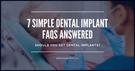 7 Simple Dental Implant Faqs Answered