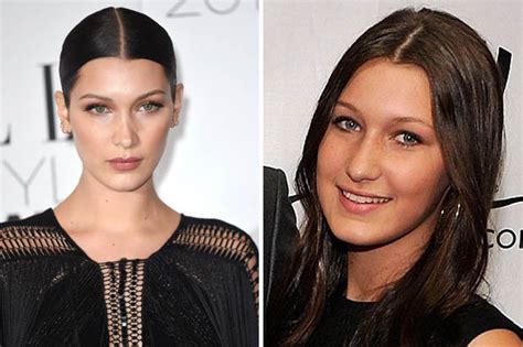 Bella Hadid Looks Unrecognisable In Teen Pic Before Plastic Surgery