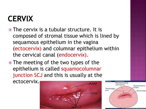 Premalignant Conditions Of The Cervix Online Presentation