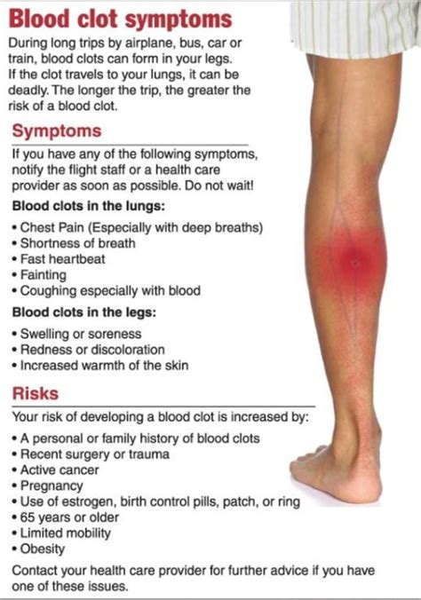 Symptoms Of Blood Clot In Leg