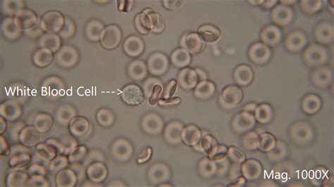 Red Blood Cells Under The Microscope Hypo And Hypertonic Solutions