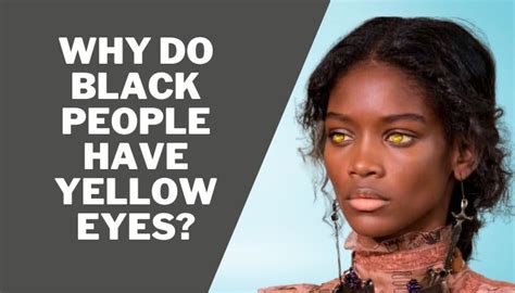 Why Do Black People Have Yellow Eyes Blackshome