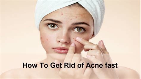 how to get rid of acne fast how to get rid of acne fast overnight and naturally youtube