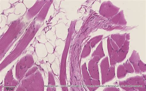 Skeletal Muscle Histology Slide