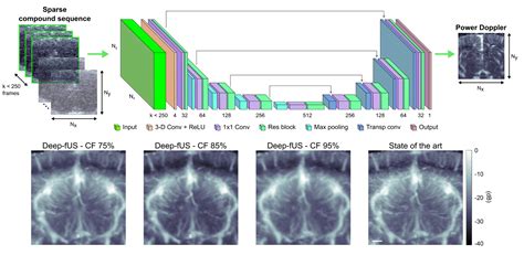 Functional Ultrasound Imaging Of The Brain Using Deep Learning And