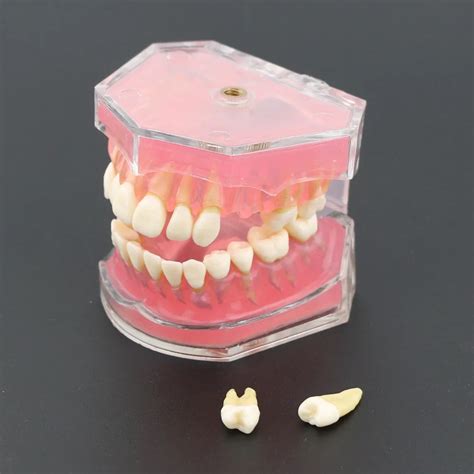 Dental Standard Model With Removable Teeth 4004 01 Dental Study Teach