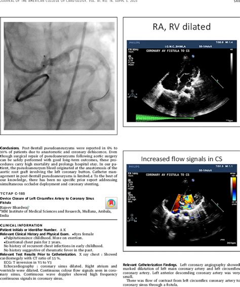 Tctap C 185 Device Closure Of Left Circumflex Artery To Coronary Sinus