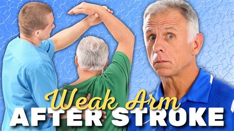 Top 3 Exercises For Weak Arm After Stroke Easy Do It Yourself Safer